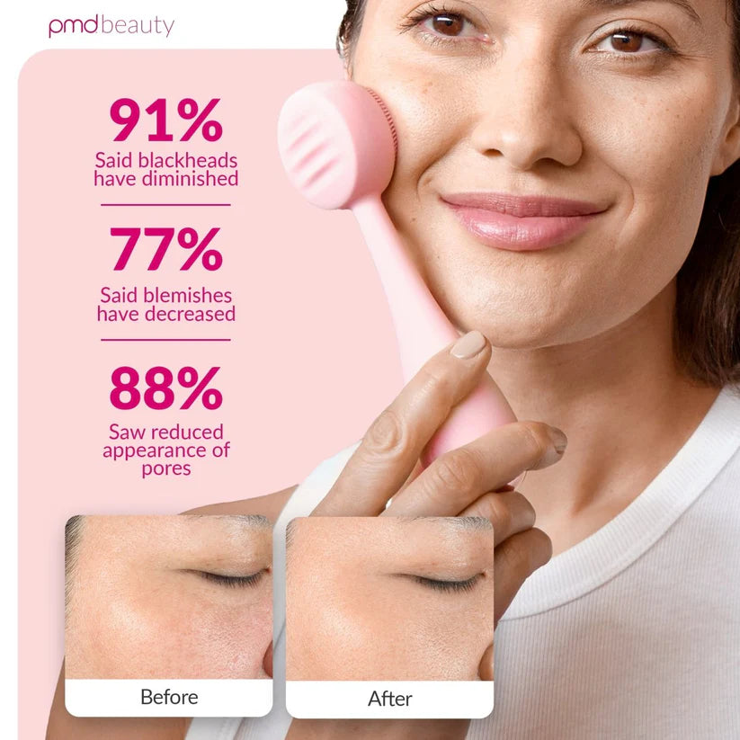 PMD Clean Facial Cleansing Device
