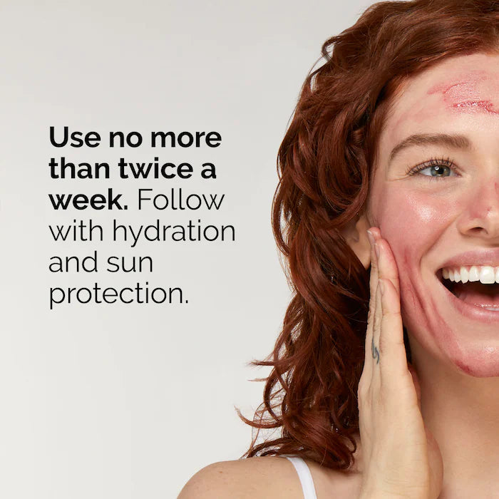 AHA 30% + BHA 2% High-Strength Peeling Solution for Brightening