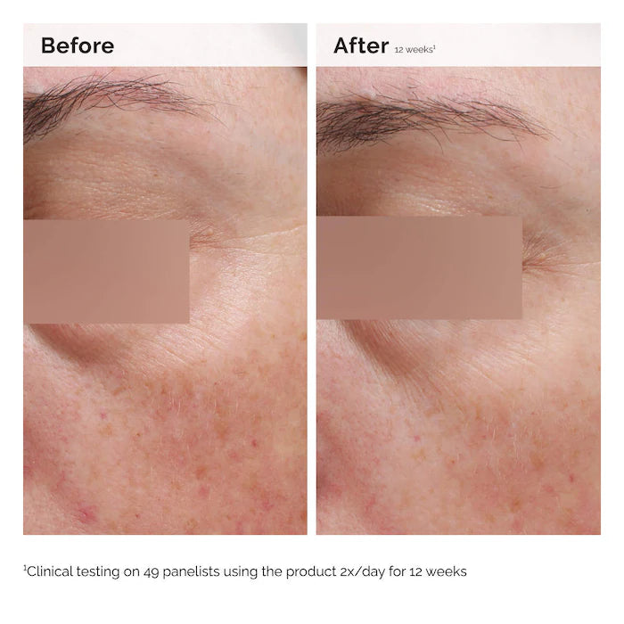 Niacinamide 5% Face and Body Emulsion for Dark Spots & Uneven Tone