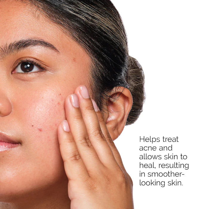 The Acne Set with Salicylic Acid